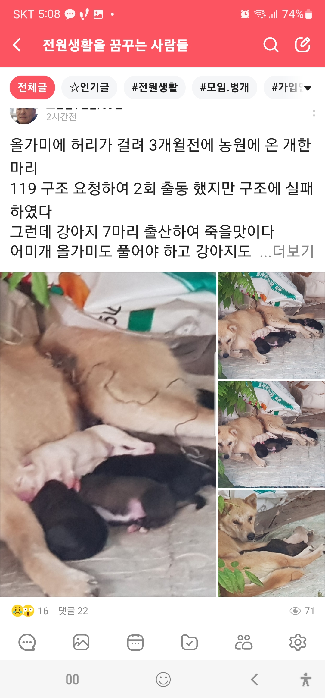 허리에 올가미 조인채 출산했습니다